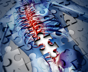 Difference Between an Incomplete and a Complete Spinal Cord Injury spinal cord injuries new york city personal injury lawyer