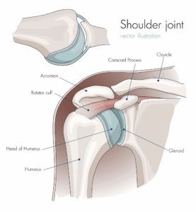 shoulder injuries after a motor vehicle accident queens car accident lawyers SLAP Tear from a Queens Car Accident: NYC Personal Injury Lawyers Explain