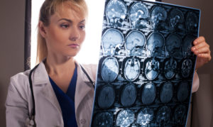 Brain Injury After a Car Accident in Queens, NY